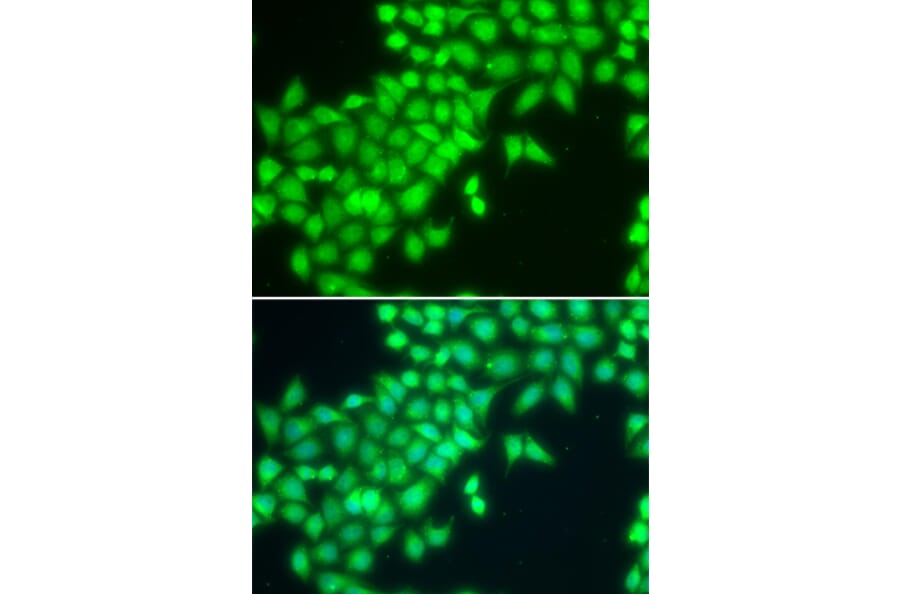Immunofluorescence - Anti-METTL2A Antibody (A7290) - Antibodies.com