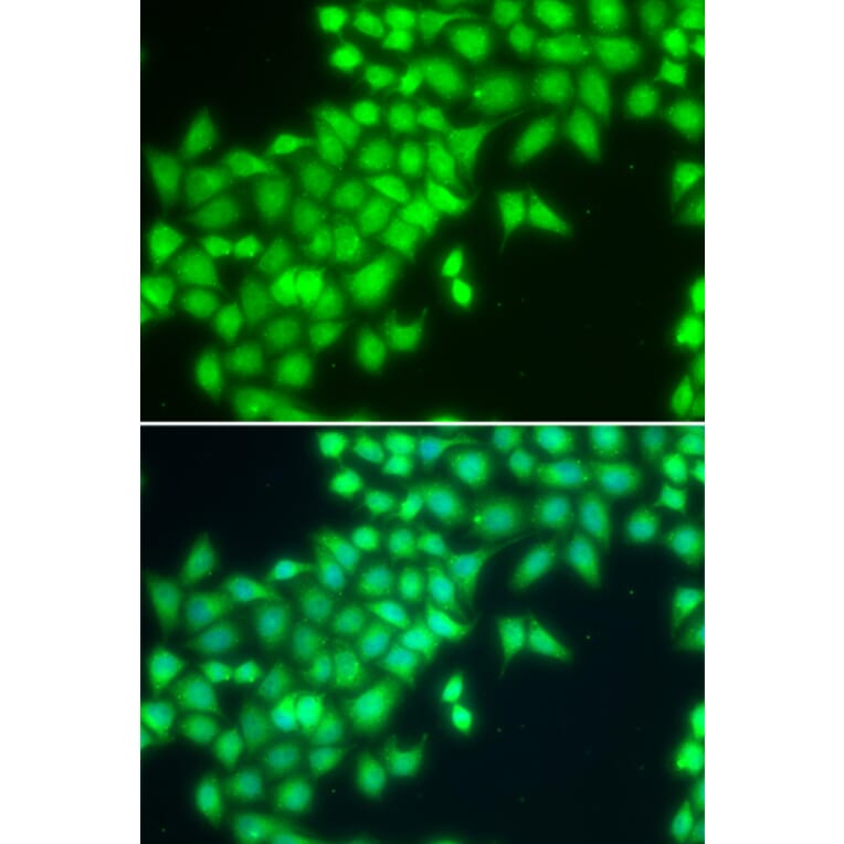 Immunofluorescence - Anti-METTL2A Antibody (A7290) - Antibodies.com