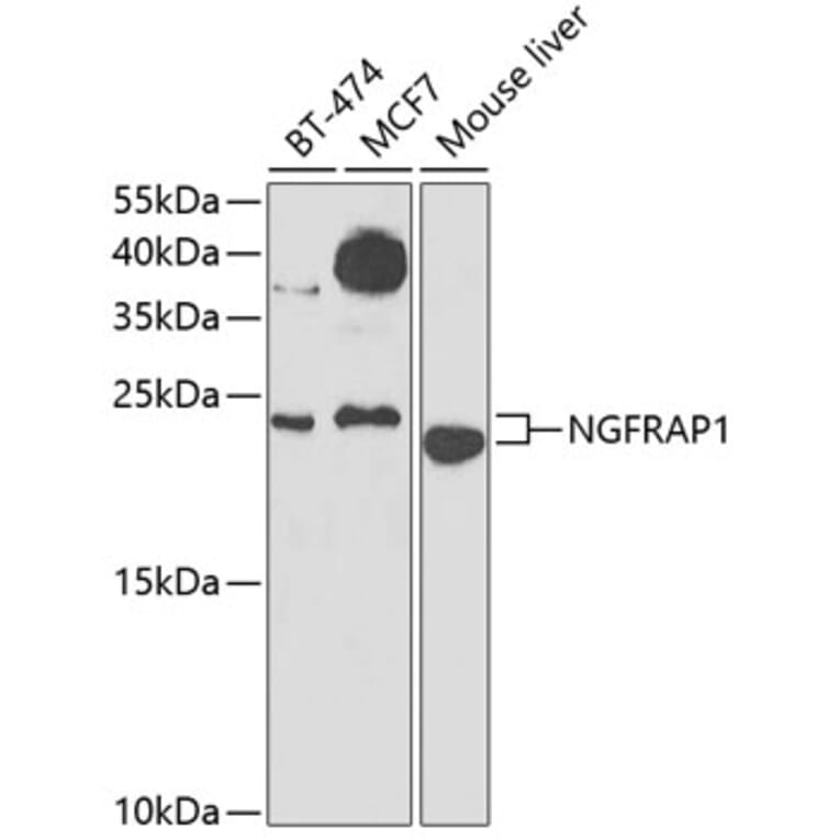 Western Blot - Anti-NGFRAP1 Antibody (A10105) - Antibodies.com