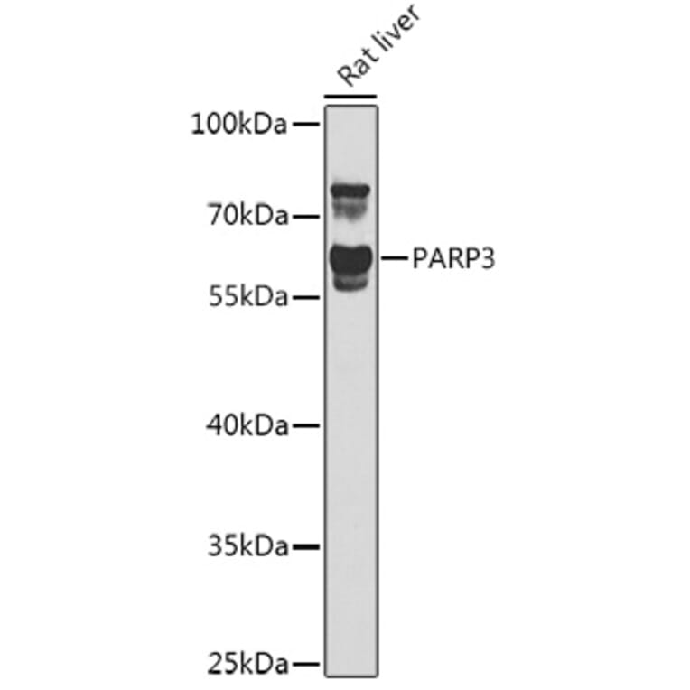 Western Blot - Anti-PARP3/IRT1 Antibody (A10106) - Antibodies.com