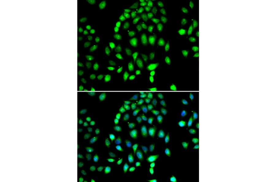 Immunofluorescence - Anti-PARP3/IRT1 Antibody (A10106) - Antibodies.com