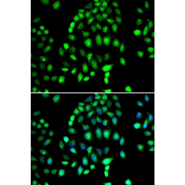 Immunofluorescence - Anti-PARP3/IRT1 Antibody (A10106) - Antibodies.com