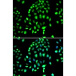 Immunofluorescence - Anti-PARP3/IRT1 Antibody (A10106) - Antibodies.com