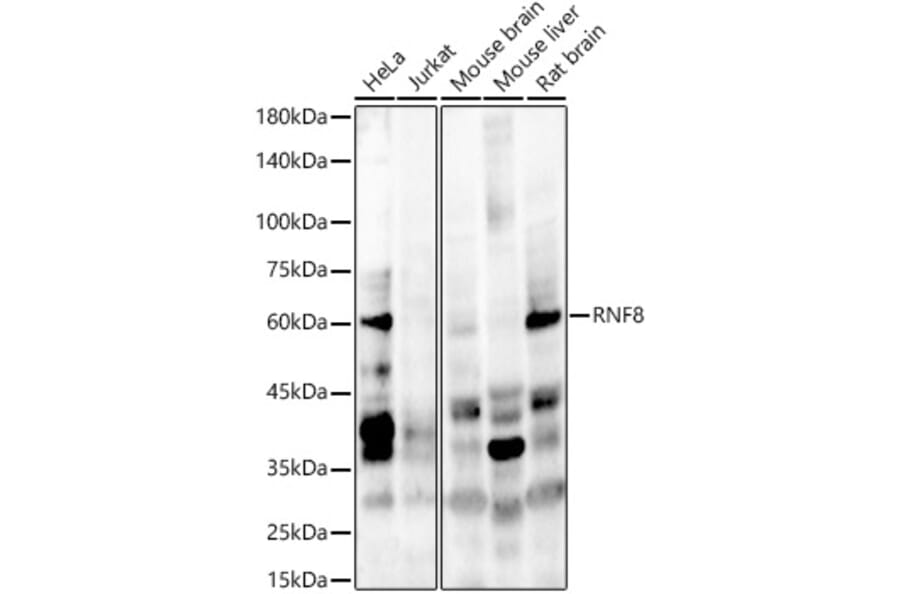 Western Blot - Anti-RNF8 Antibody (A10107) - Antibodies.com