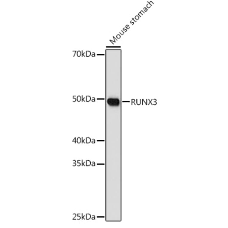 Western Blot - Anti-RUNX3 Antibody (A10108) - Antibodies.com