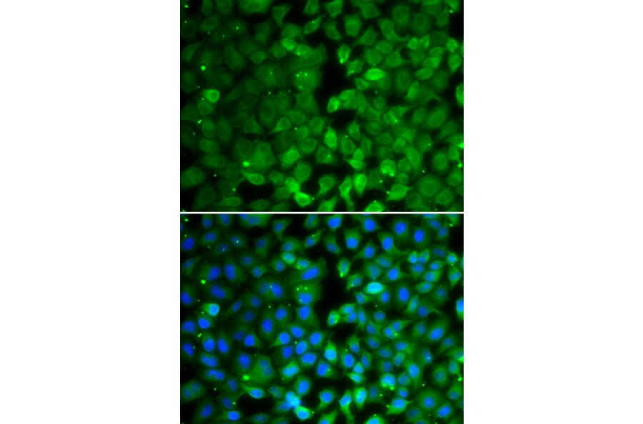 Immunofluorescence - Anti-RUNX3 Antibody (A10108) - Antibodies.com