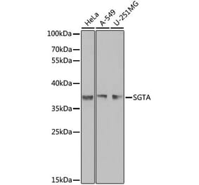 Western Blot - Anti-SGTA Antibody (A7306) - Antibodies.com