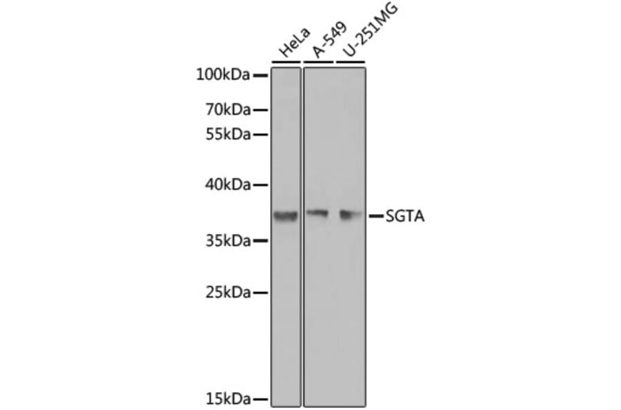 Western Blot - Anti-SGTA Antibody (A7306) - Antibodies.com