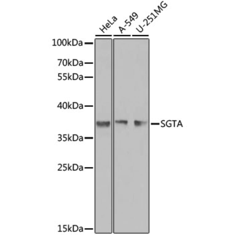 Western Blot - Anti-SGTA Antibody (A7306) - Antibodies.com