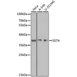 Western Blot - Anti-SGTA Antibody (A7306) - Antibodies.com