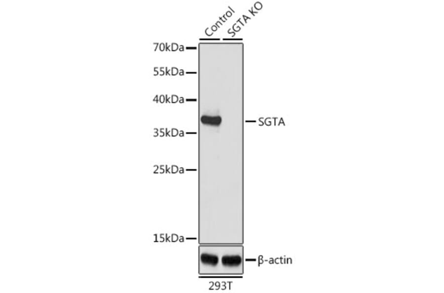 Western Blot - Anti-SGTA Antibody (A7306) - Antibodies.com
