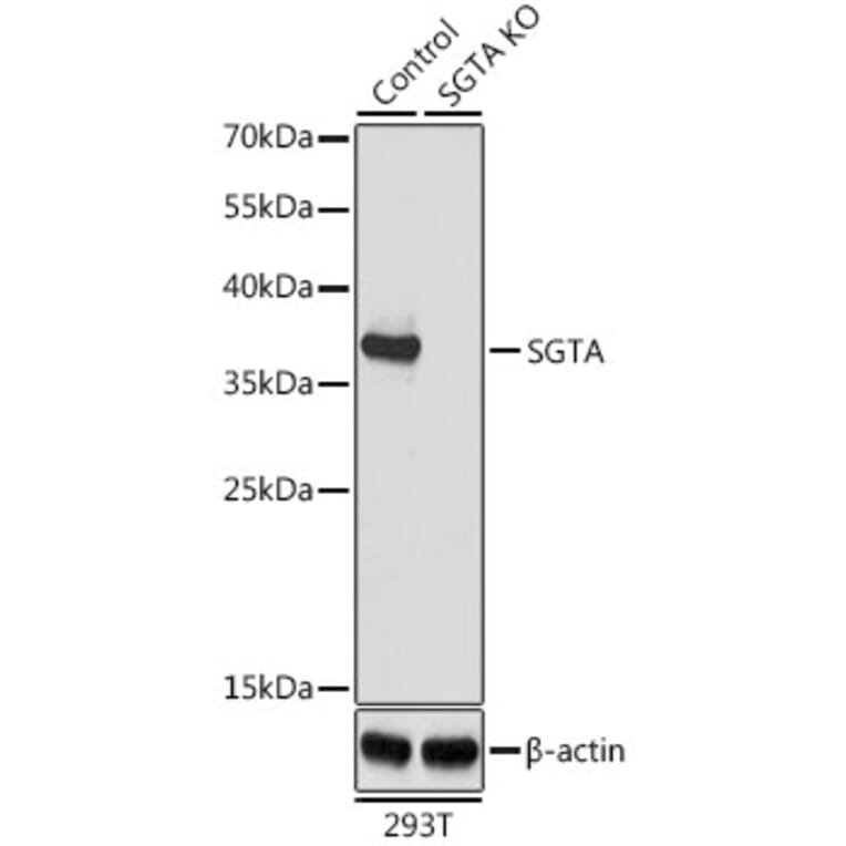 Western Blot - Anti-SGTA Antibody (A7306) - Antibodies.com