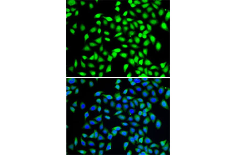 Immunofluorescence - Anti-SGTA Antibody (A7306) - Antibodies.com