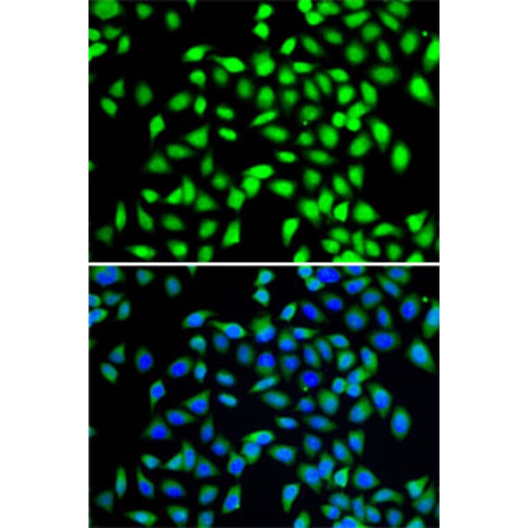 Immunofluorescence - Anti-SGTA Antibody (A7306) - Antibodies.com
