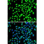 Immunofluorescence - Anti-SGTA Antibody (A7306) - Antibodies.com