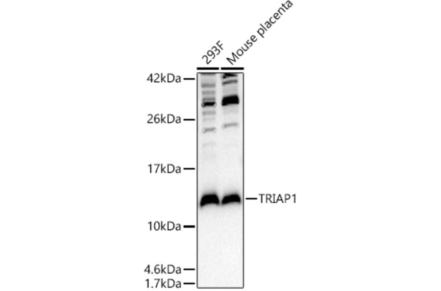 Western Blot - Anti-TRIAP1 Antibody (A10110) - Antibodies.com