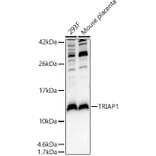 Western Blot - Anti-TRIAP1 Antibody (A10110) - Antibodies.com