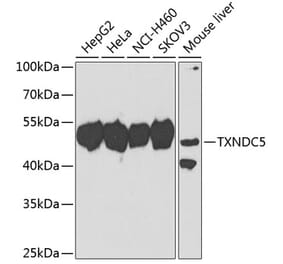 Western Blot - Anti-TXNDC5 Antibody (A10111) - Antibodies.com