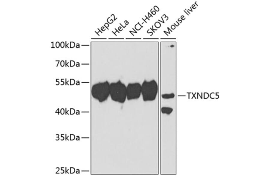 Western Blot - Anti-TXNDC5 Antibody (A10111) - Antibodies.com