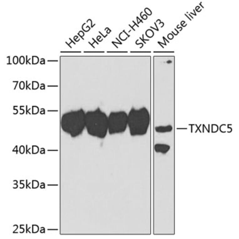 Western Blot - Anti-TXNDC5 Antibody (A10111) - Antibodies.com