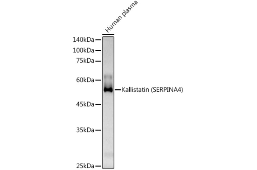 Western Blot - Anti-Kallistatin/PI-4 Antibody (A10112) - Antibodies.com
