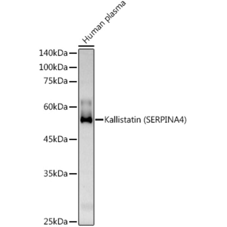 Western Blot - Anti-Kallistatin/PI-4 Antibody (A10112) - Antibodies.com