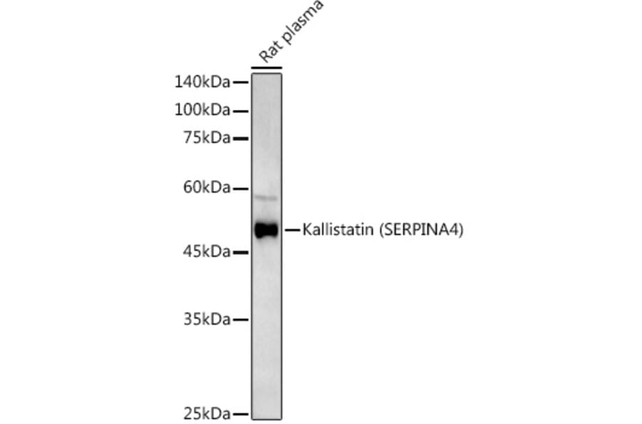 Western Blot - Anti-Kallistatin/PI-4 Antibody (A10112) - Antibodies.com
