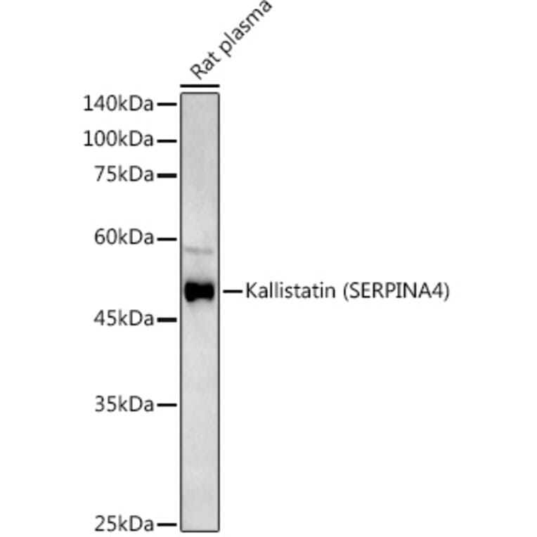 Western Blot - Anti-Kallistatin/PI-4 Antibody (A10112) - Antibodies.com