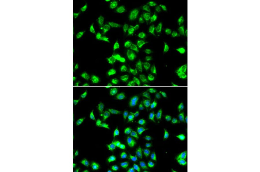Immunofluorescence - Anti-Kallistatin/PI-4 Antibody (A10112) - Antibodies.com