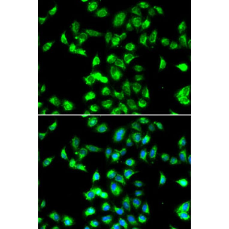 Immunofluorescence - Anti-Kallistatin/PI-4 Antibody (A10112) - Antibodies.com