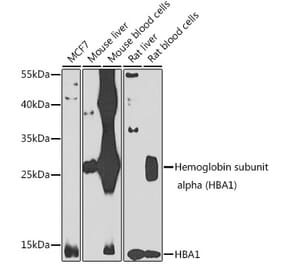 Western Blot - Anti-Hemoglobin subunit alpha Antibody (A10113) - Antibodies.com