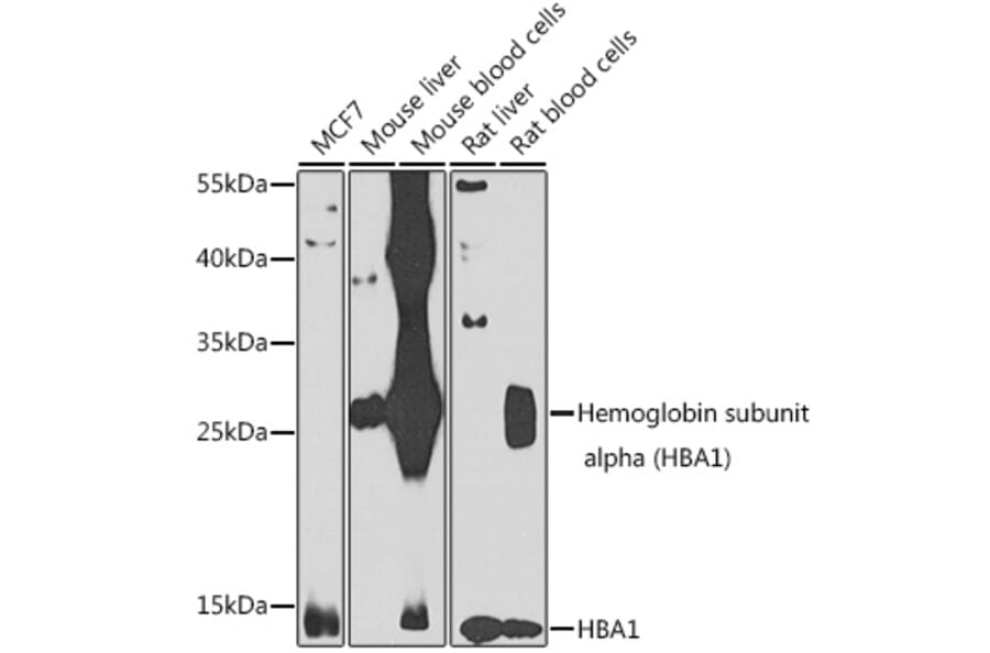 Western Blot - Anti-Hemoglobin subunit alpha Antibody (A10113) - Antibodies.com