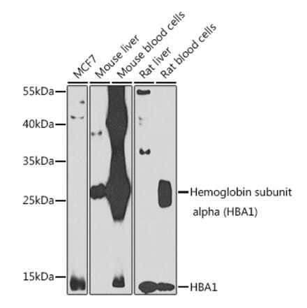 Western Blot - Anti-Hemoglobin subunit alpha Antibody (A10113) - Antibodies.com