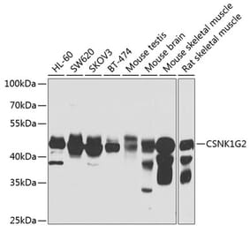 Western Blot - Anti-CSNK1G2 Antibody (A7326) - Antibodies.com