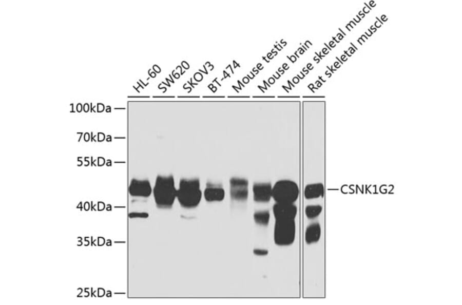 Western Blot - Anti-CSNK1G2 Antibody (A7326) - Antibodies.com