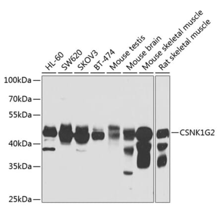 Western Blot - Anti-CSNK1G2 Antibody (A7326) - Antibodies.com