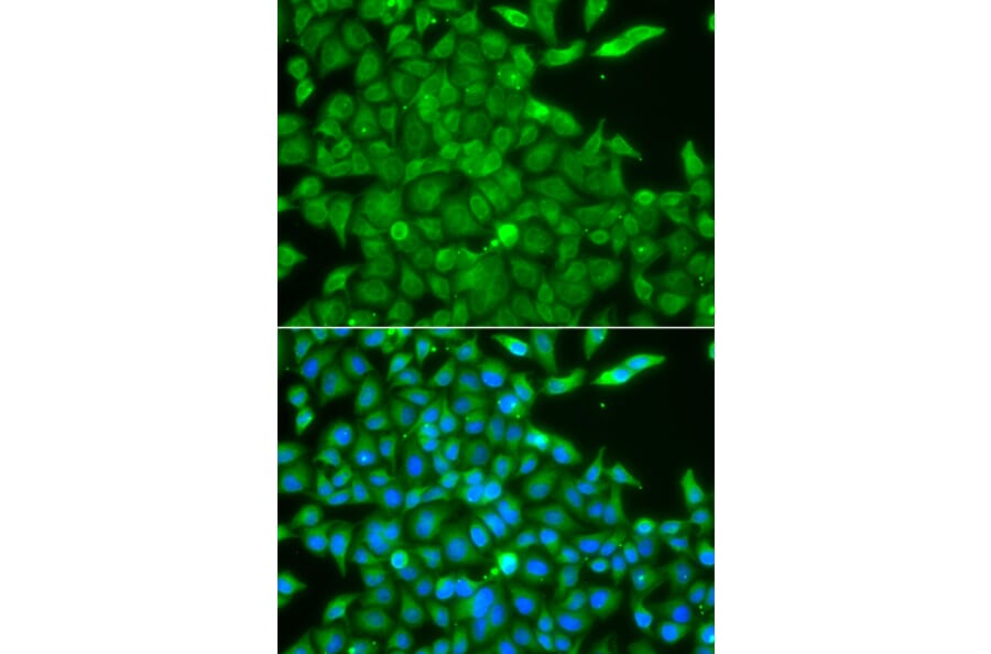 Immunofluorescence - Anti-CSNK1G2 Antibody (A7326) - Antibodies.com