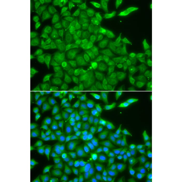 Immunofluorescence - Anti-CSNK1G2 Antibody (A7326) - Antibodies.com