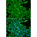 Immunofluorescence - Anti-CSNK1G2 Antibody (A7326) - Antibodies.com