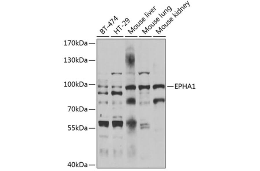 Western Blot - Anti-EPHA1 Antibody (A7328) - Antibodies.com