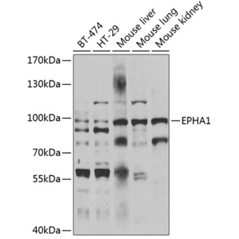 Western Blot - Anti-EPHA1 Antibody (A7328) - Antibodies.com