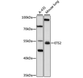 Western Blot - Anti-ETS2 Antibody (A10117) - Antibodies.com