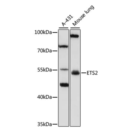 Western Blot - Anti-ETS2 Antibody (A10117) - Antibodies.com