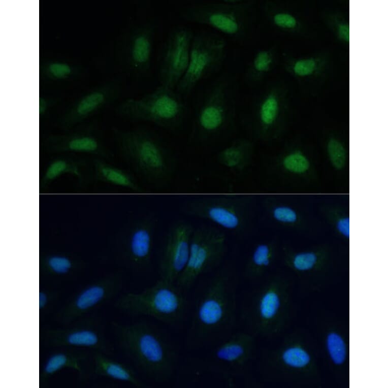 Immunofluorescence - Anti-ETS2 Antibody (A10117) - Antibodies.com