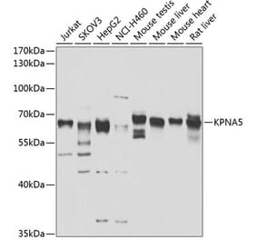 Western Blot - Anti-KPNA5 Antibody (A10118) - Antibodies.com