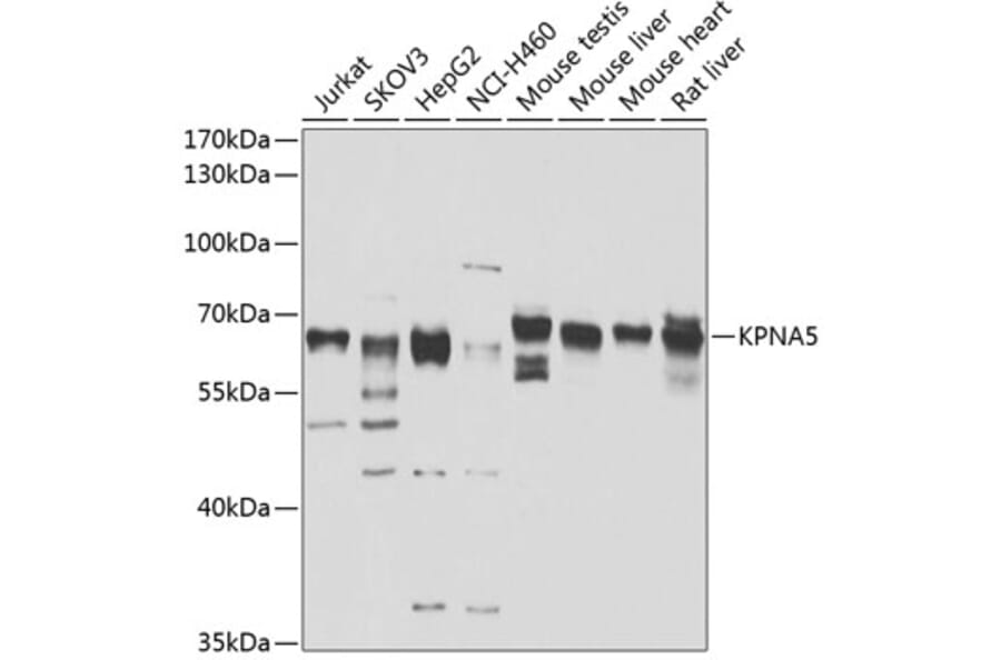 Western Blot - Anti-KPNA5 Antibody (A10118) - Antibodies.com