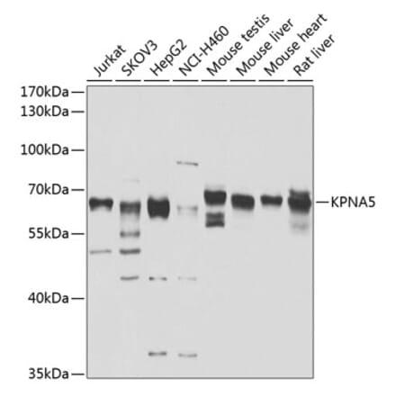 Western Blot - Anti-KPNA5 Antibody (A10118) - Antibodies.com