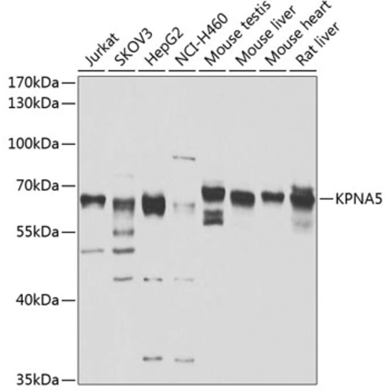 Western Blot - Anti-KPNA5 Antibody (A10118) - Antibodies.com