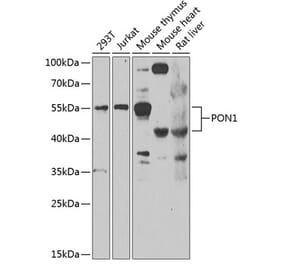 Western Blot - Anti-PON1 Antibody (A10119) - Antibodies.com