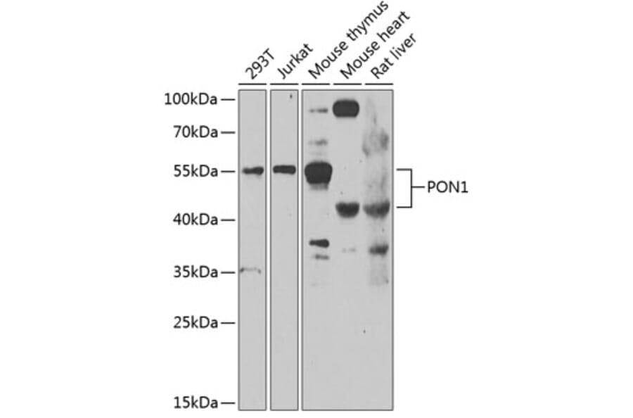 Western Blot - Anti-PON1 Antibody (A10119) - Antibodies.com
